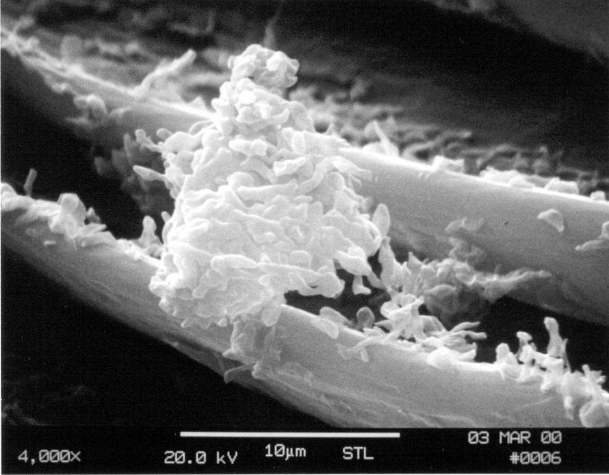 C:\Users\Owner\Desktop\Connie bulletin photo\respirable bird bloom particles on a cockatiel's wing 4000x SEM.JPG