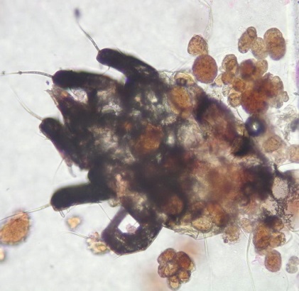 C:\Users\Owner\Desktop\Connie's  Documents\Publicity\Client newsletter\300-micron Acarus mite surrounded by fecal pellets from a kitchen sink rim.JPG