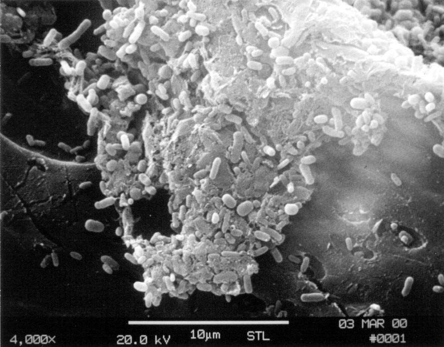 C:\Users\Owner\Downloads\09.03 Sponge w ss bacteria SEM 4k BW jpg.JPG