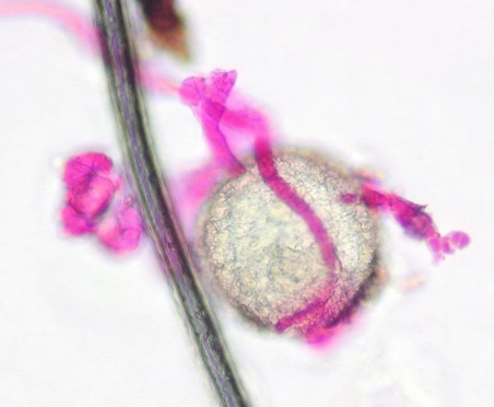 C:\Users\jeff\Desktop\May's Ways Exterior\pollen grain with growing mold, hyphae stained pink 9232.JPG