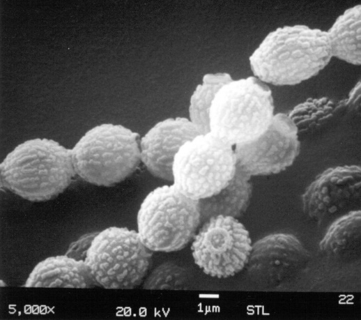 C:\Users\Owner\Desktop\Macro Micro Client NL spring 2022\Aspergillus spore chain SEM 5k jpg .jpg