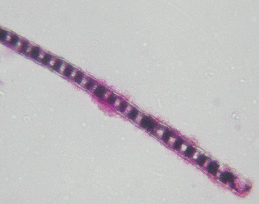 C:\Users\Owner\Desktop\May's Ways September 22\Mouse hair covered with Aspergillus spores from urine trail 7488.JPG