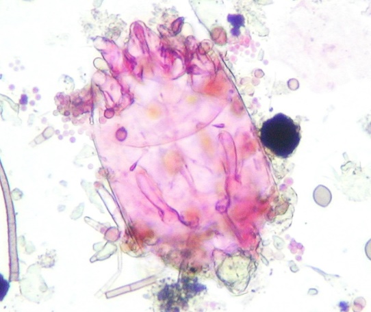C:\Users\Owner\Desktop\In Process Newsletters August 2023\Back to School\Mold-eating mite [pink stained] surrounded by spores from a moldy carpet.JPG