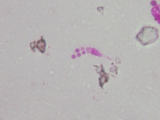 C:\Users\Owner\Desktop\Adaptive Reuse\Penicillium conidiophore in dust taken from crack in ceiling.JPG